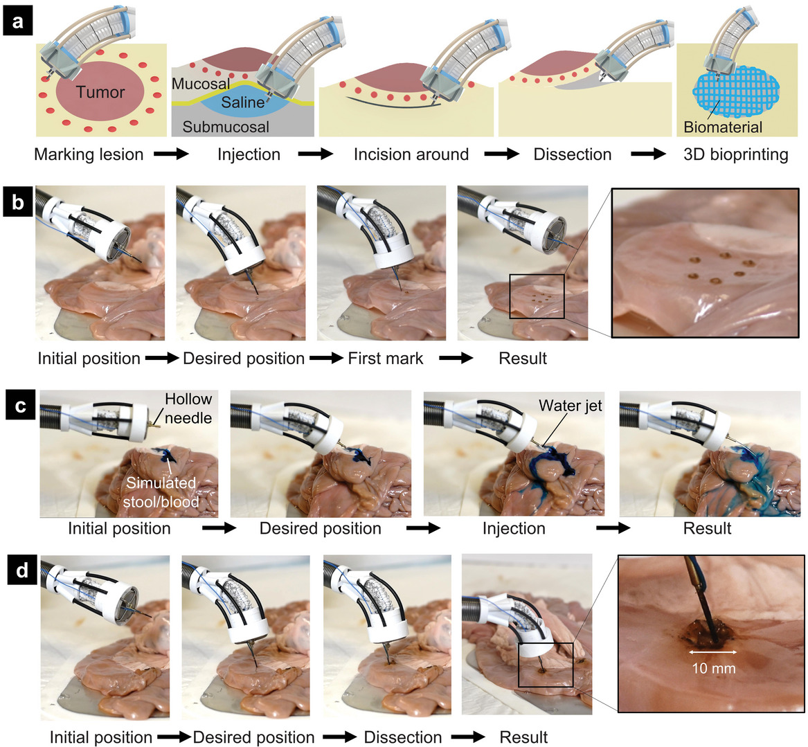 Advanced Science: в Австралии разработан робот-рука для 3D-печати на органах внутри тела