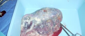 Ученые нашли микропластики в плаценте женщин, рожавших на Гавайях